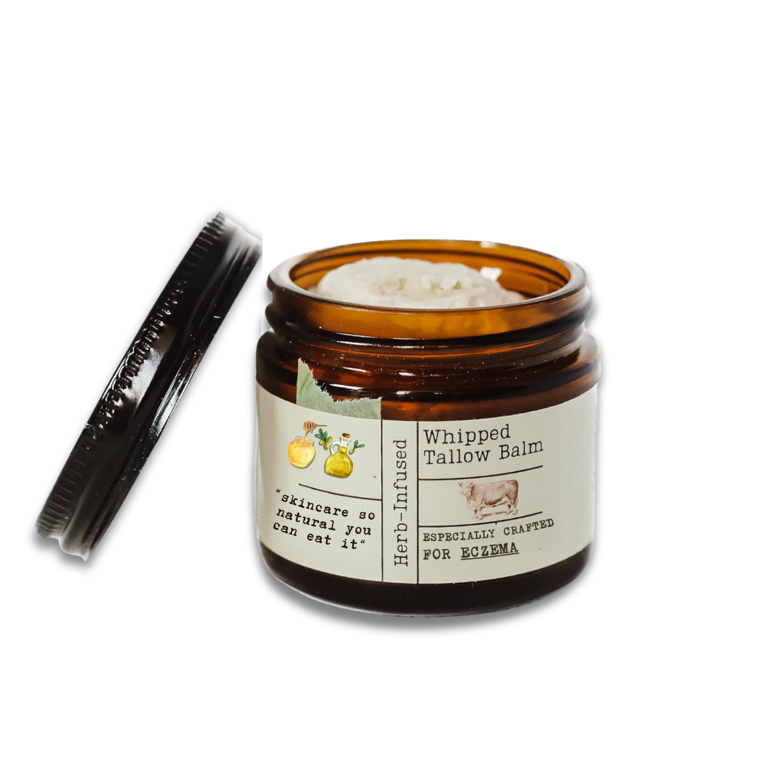 Eczema Whipped Tallow & Honey Balm