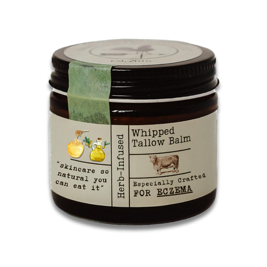 Eczema Whipped Tallow & Honey Balm